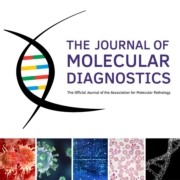 New technique to measure circulating tumor DNA in metastatic cancer